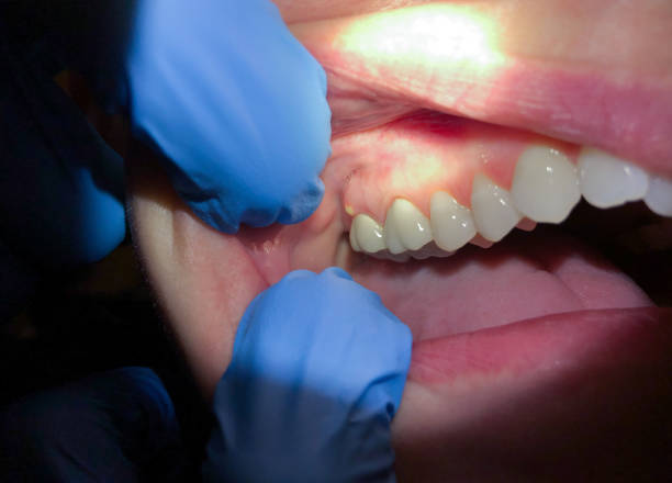 Best Urgent Care for Lost Fillings or Crowns in Shiloh, PA
