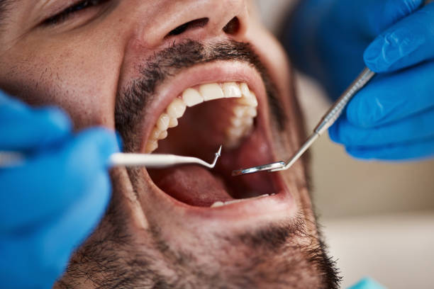 Best Emergency Tooth Extraction in Shiloh, PA